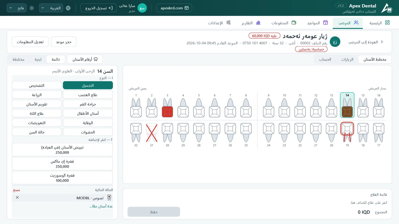 أبكس دنتال — مخطط الأسنان