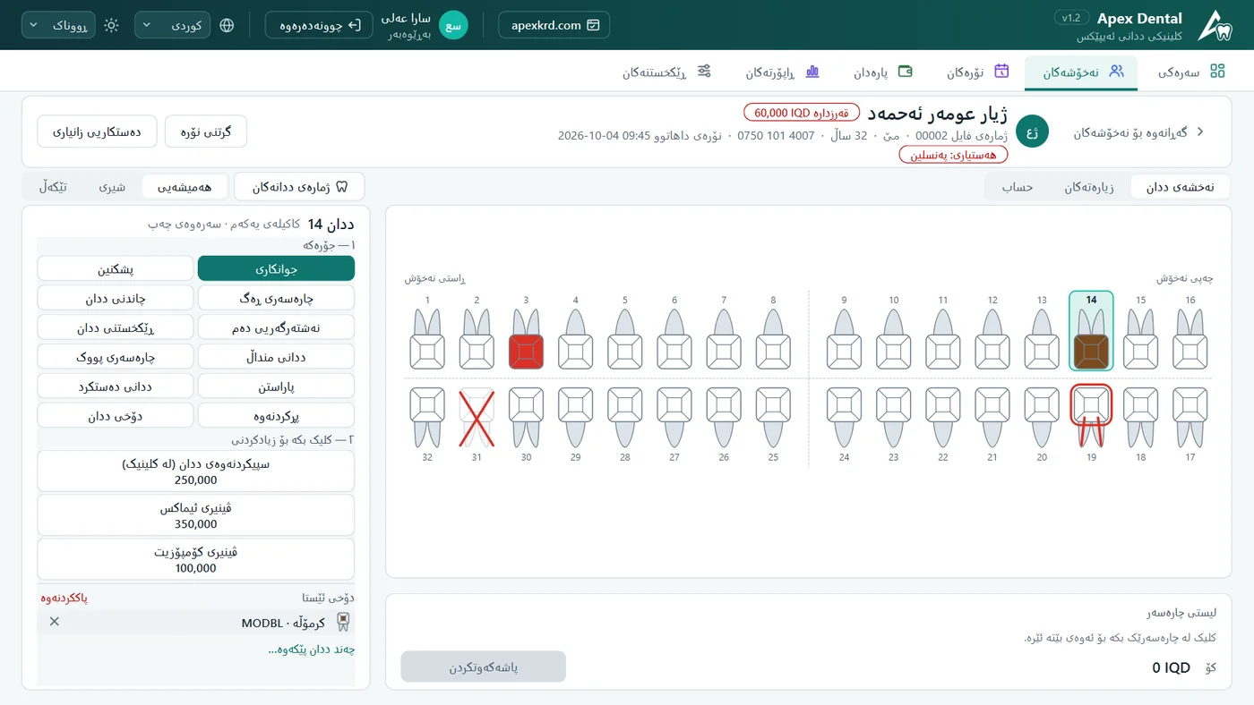 ئەپێکس دێنتاڵ — نەخشەی ددان